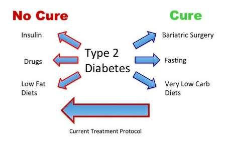type 2 diabetes treatment